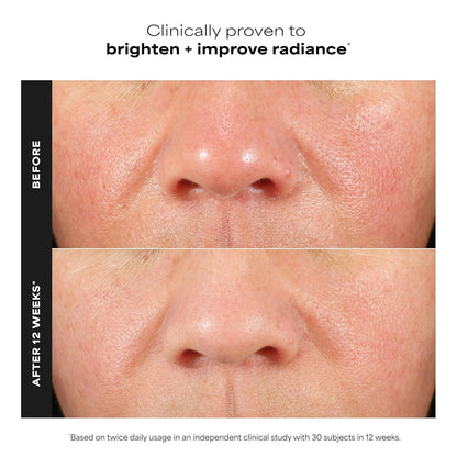 Peter Thomas Roth | Potent-C Power Serum | Brightening Vitamin C Serum for Fine Lines, Wrinkles, Uneven Skin Tone..