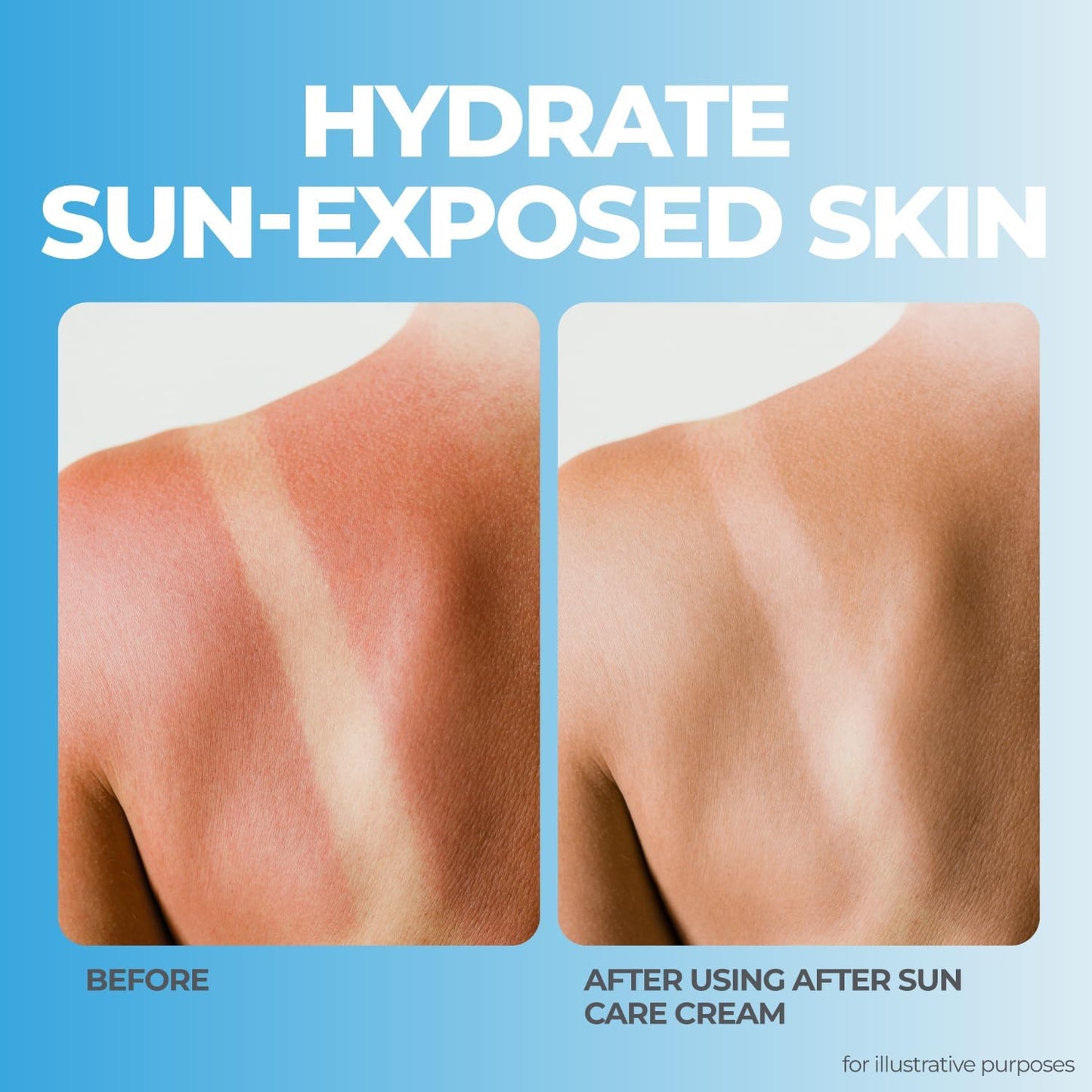 terrasil After Sun Care Lotion with Aloe Vera, Shea Butter, Coconut Oil, &amp; Vitamin E, Soothing Sunburn Relief for Sun Exposed Skin..