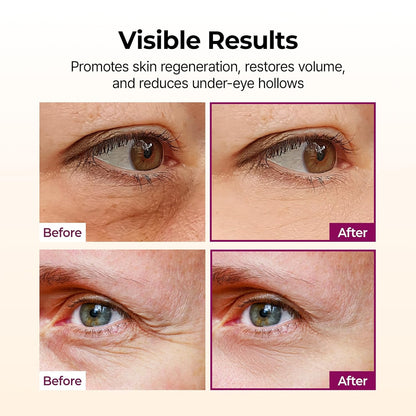 Dr.Melaxin Collagen Multi Balm Stick, Calcium &amp; Adenosine Korean Wrinkle Stick for Eye, Neck & Face..