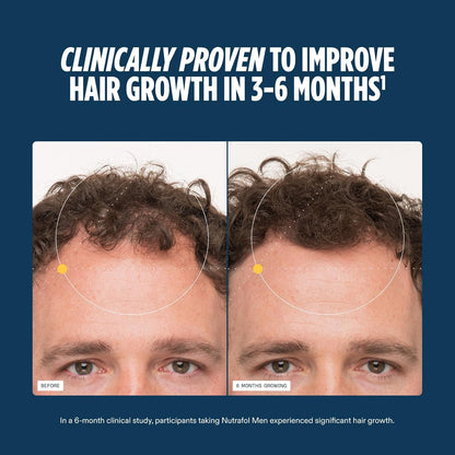 Nutrafol Men's Hair Growth Supplements, Clinically Tested for Visibly Thicker Hair and Scalp Coverage..