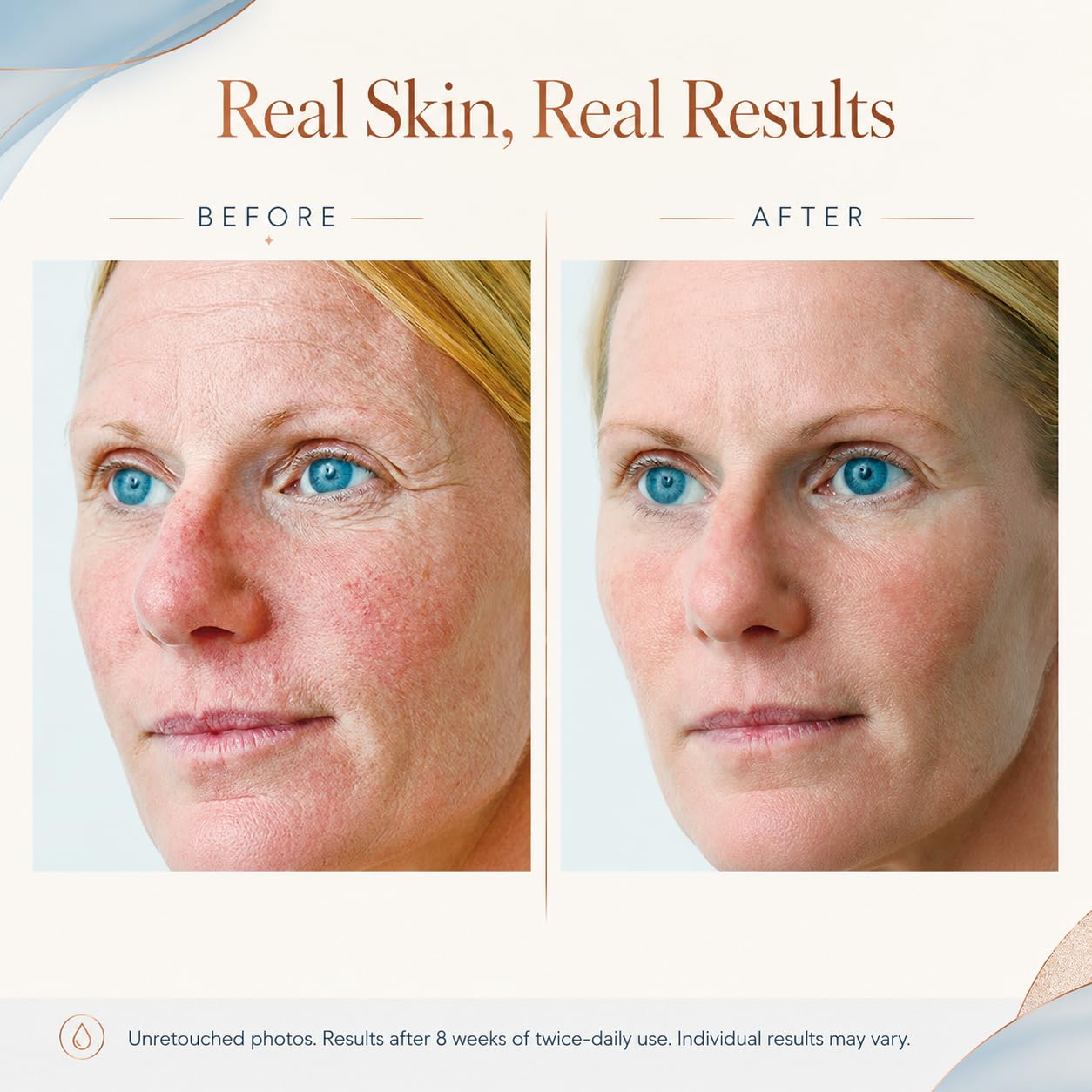 Osmotics Blue Copper 5 Firming Elasticity Repair – Copper Peptide Anti-Aging Face Cream..