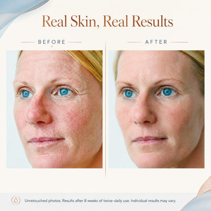 Osmotics Blue Copper 5 Firming Elasticity Repair – Copper Peptide Anti-Aging Face Cream..