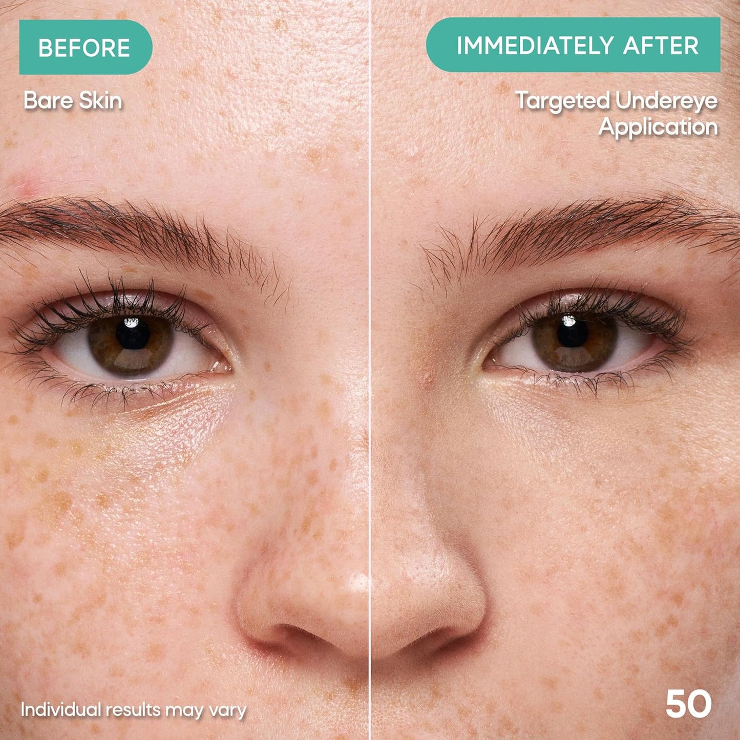 Almay Clear Complexion Concealer, 200, 0.3 fl oz | Full-coverage concealer treats acne and visibly evens skin tone over time..