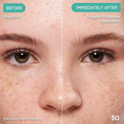 Almay Clear Complexion Concealer, 200, 0.3 fl oz | Full-coverage concealer treats acne and visibly evens skin tone over time..