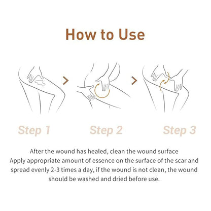 Acne Scar Removal Cream, Herbal Fade Scar Marks Burns Repair Cream, Stretch Marks Face Skin Cream Shrink Pores Gel..