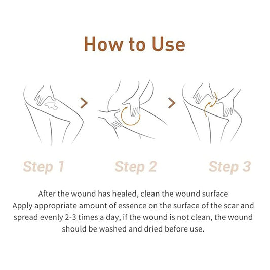 Acne Scar Removal Cream, Herbal Fade Scar Marks Burns Repair Cream, Stretch Marks Face Skin Cream Shrink Pores Gel..