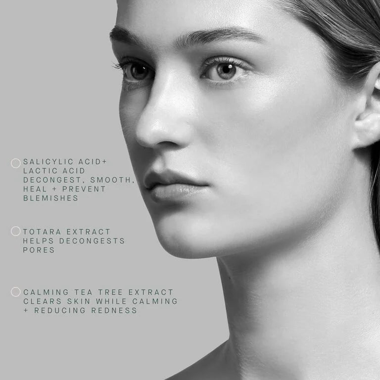 ARCONA AM Blemish Lotion – 3% Salicylic, 2% Lactic Acids, Tea Tree Extract, Witch Hazel, Jojoba Seed Oil