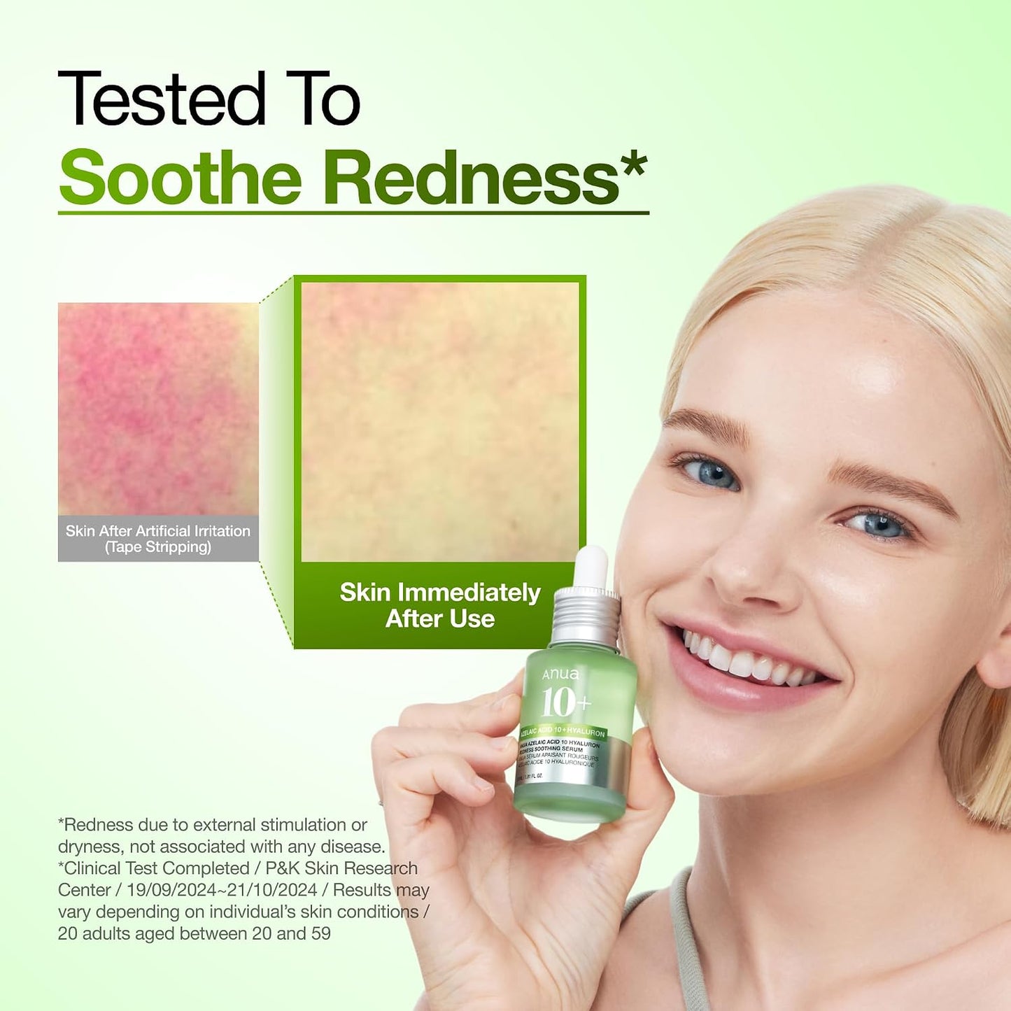 Anua Azelaic Acid 10 Hyaluron Redness Soothing Serum, Facial Serum for Blemish-Prone &amp; Oily-Prone Skin..