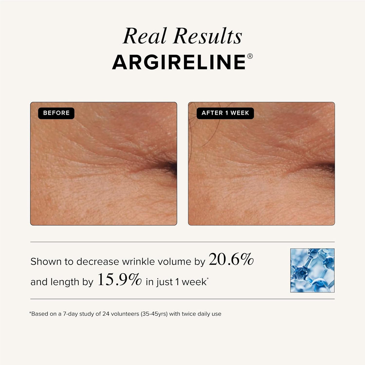 Asterwood Triple Repair Peptide Serum, Matrixyl 3000, Argireline & Vit. C,  8 Fl Oz..
