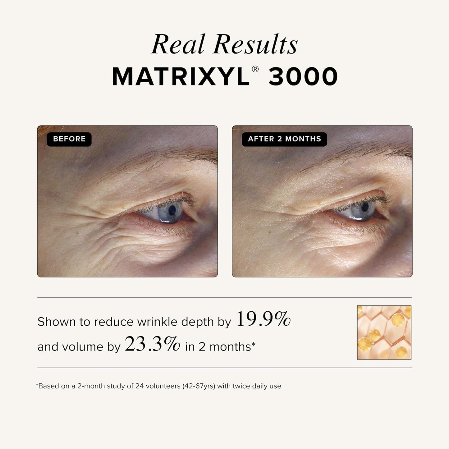Asterwood Matrixyl 3000 + Argireline Serum for Face - Multi Peptide Serum with Hyaluronic Acid..