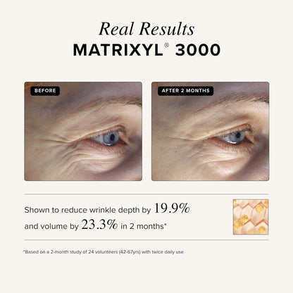 Asterwood Matrixyl 3000 + Argireline Serum for Face - Multi Peptide Serum with Hyaluronic Acid..