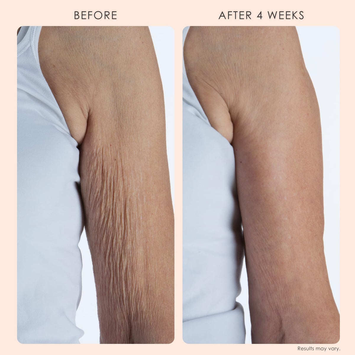 BODY FIRM Crepe Erase Body Repair Treatment, Anti-Aging Wrinkle Cream
