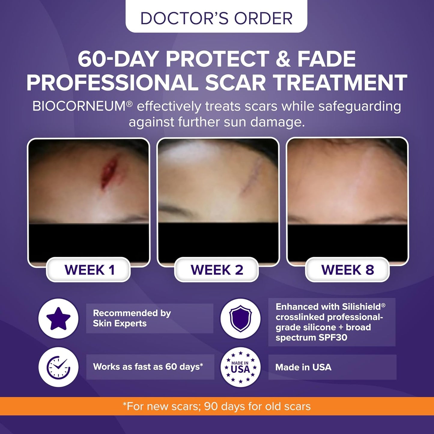 Biocorneum Silicone Scar Gel with SPF 30, Fast-Drying Scar Cream, 10g | Advanced Scar Treatment with Silishield®..