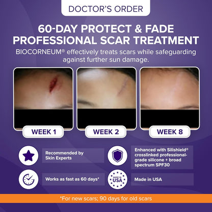 Biocorneum Silicone Scar Gel with SPF 30, Fast-Drying Scar Cream, 10g | Advanced Scar Treatment with Silishield®..