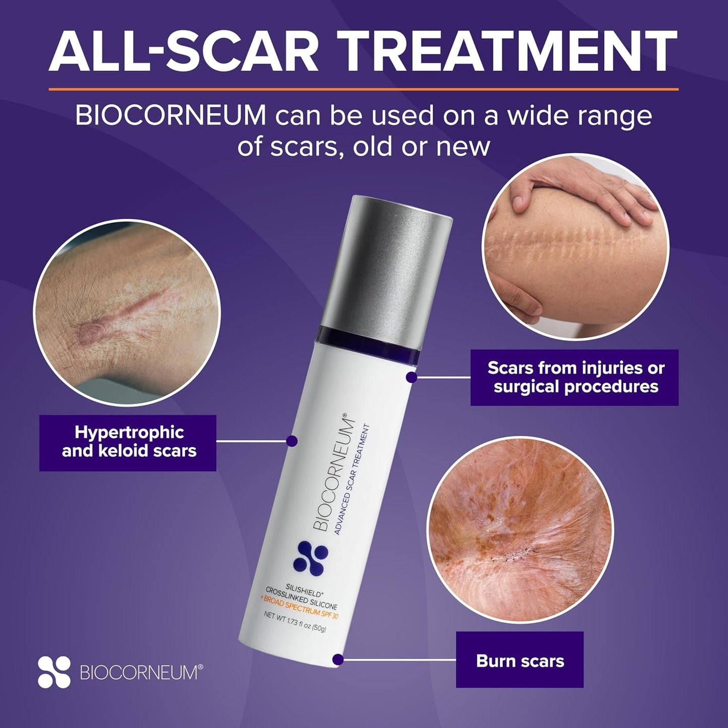 Biocorneum Silicone Scar Gel with SPF 30, Fast-Drying Scar Cream, 10g | Advanced Scar Treatment with Silishield®..