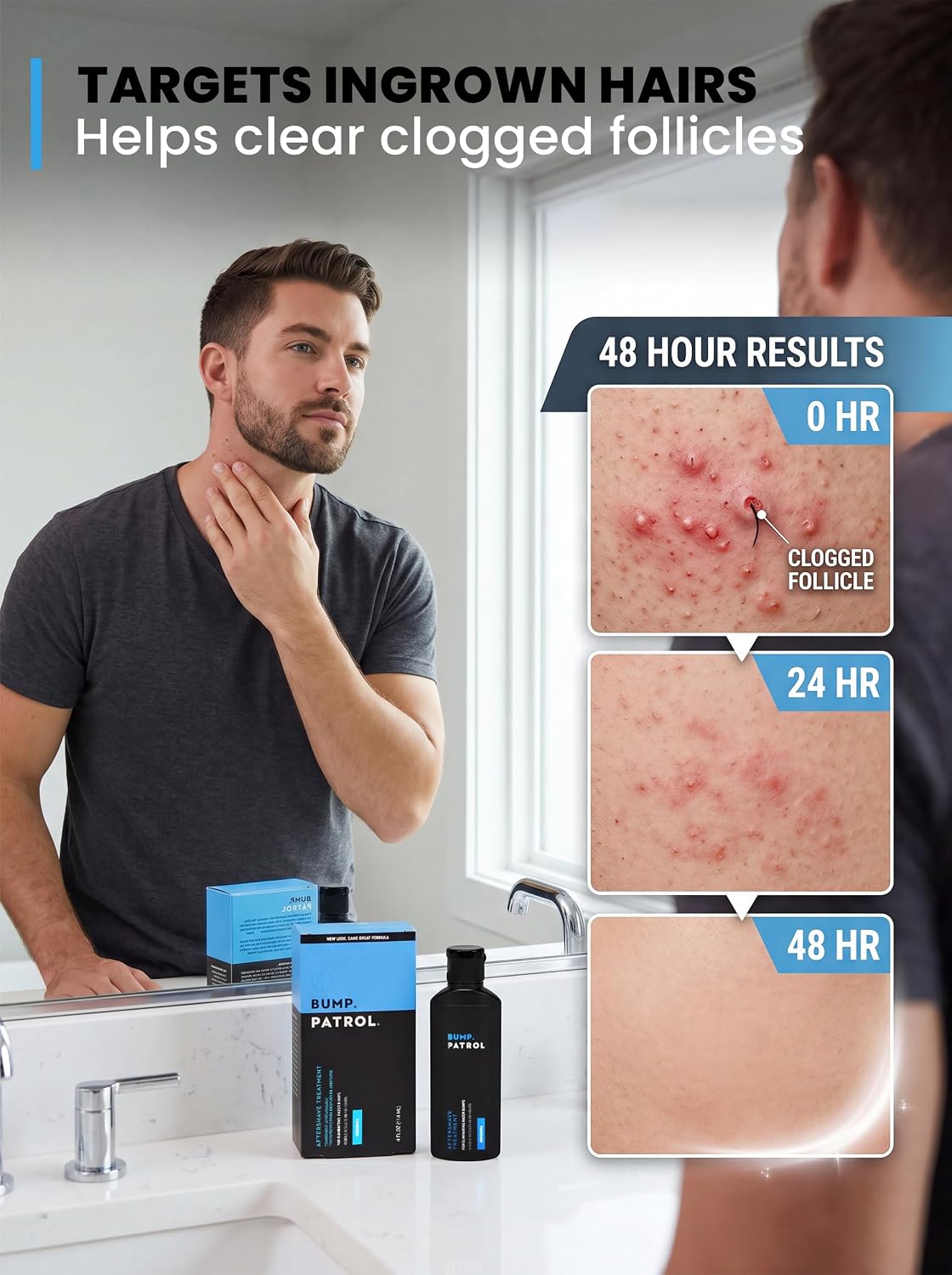 Bump Patrol Original Formula Aftershave Treatment Serum – Razor Bump Stopper and Ingrown Hair Treatment for Men and Women..