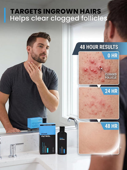 Bump Patrol Original Formula Aftershave Treatment Serum – Razor Bump Stopper and Ingrown Hair Treatment for Men and Women..