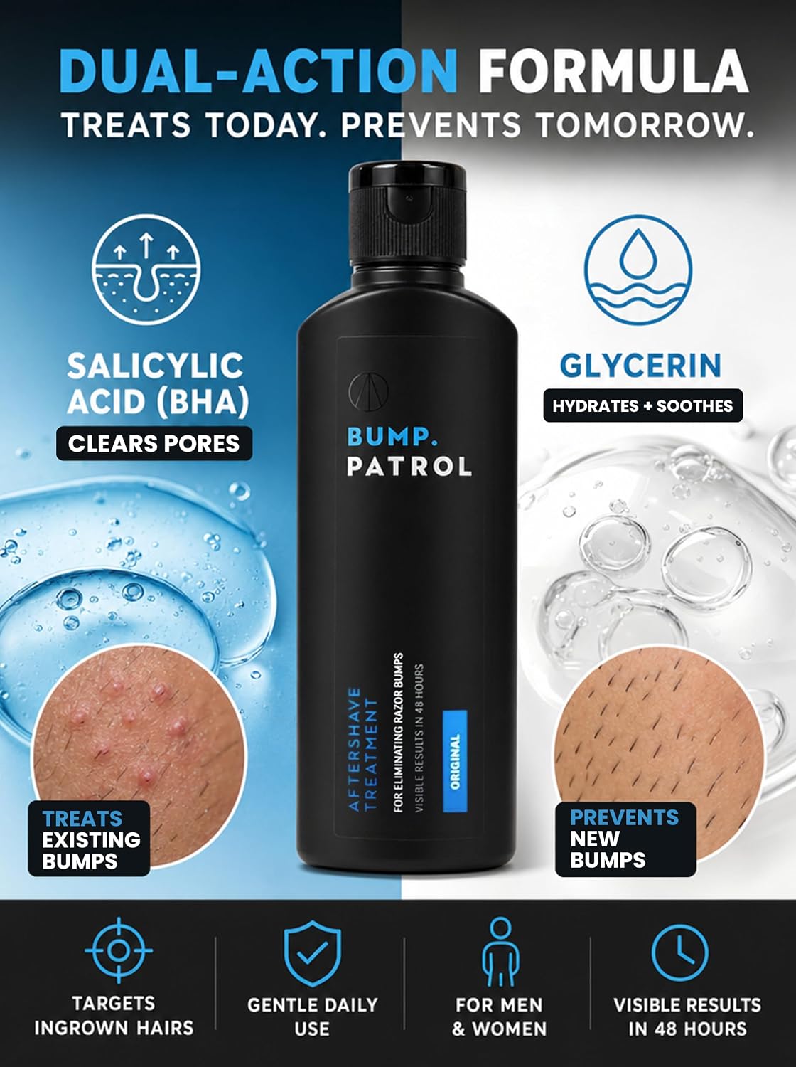 Bump Patrol Original Formula Aftershave Treatment Serum – Razor Bump Stopper and Ingrown Hair Treatment for Men and Women..