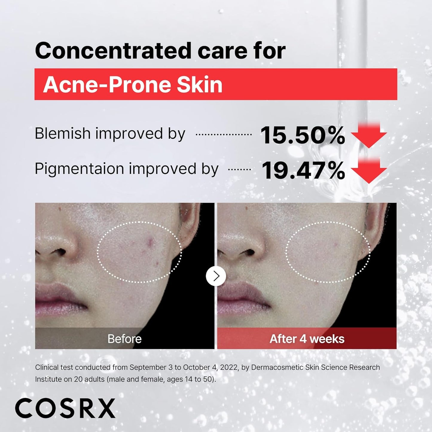 COSRX 15% Niacinamide Face Serum, 0.67 fl oz, Pore Minimizer Serum for Face