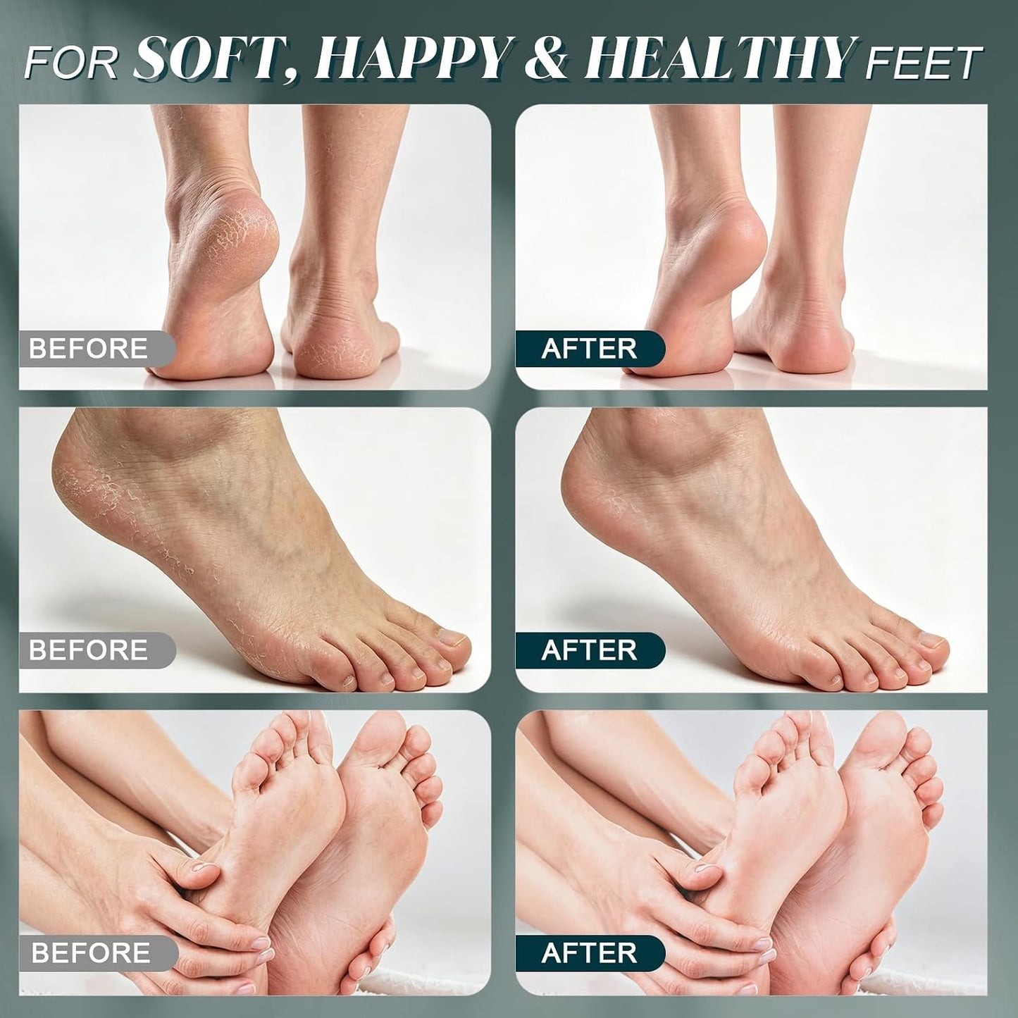【Sea Salt Exfoliating Scrub】 – Foot Care Scrub for Dead Skin, Calluses & Cracked Heels ..