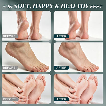 【Sea Salt Exfoliating Scrub】 – Foot Care Scrub for Dead Skin, Calluses & Cracked Heels ..