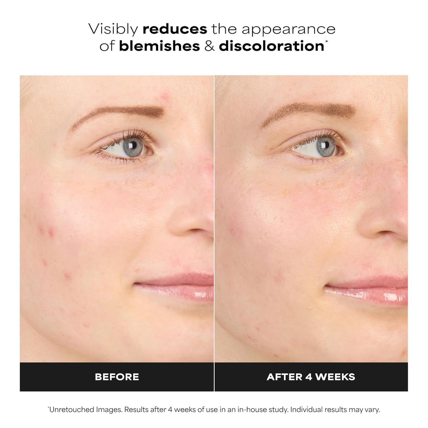 Paula's Choice BOOST 10% Azelaic Acid Booster Cream Gel Face Serum with Salicylic Acid..
