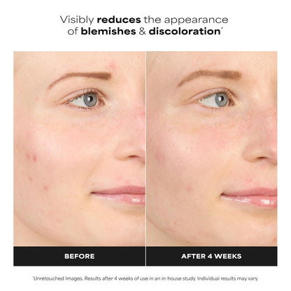 Paula's Choice BOOST 10% Azelaic Acid Booster Cream Gel Face Serum with Salicylic Acid..