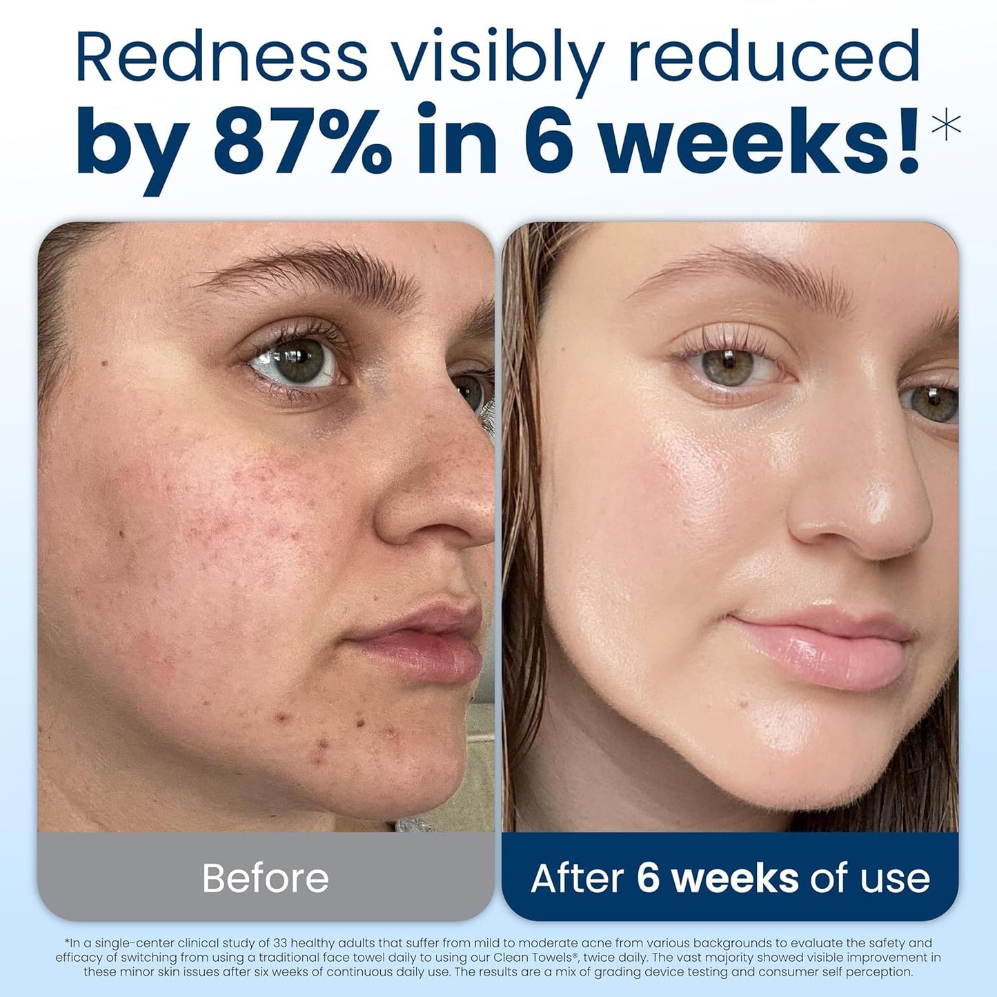 Clean Skin Club Clean Towels XL®, 100% USDA Biobased Face Towel, Disposable Face Towelette, Eczema Association Accepted..
