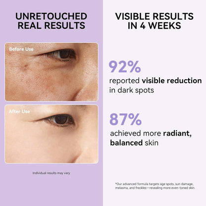 Dark Spot Remover for Face and Body - Dark Spot Corrector Serum for Sun Spots, Age Spots, Brown Spot, Freckles & Melasma