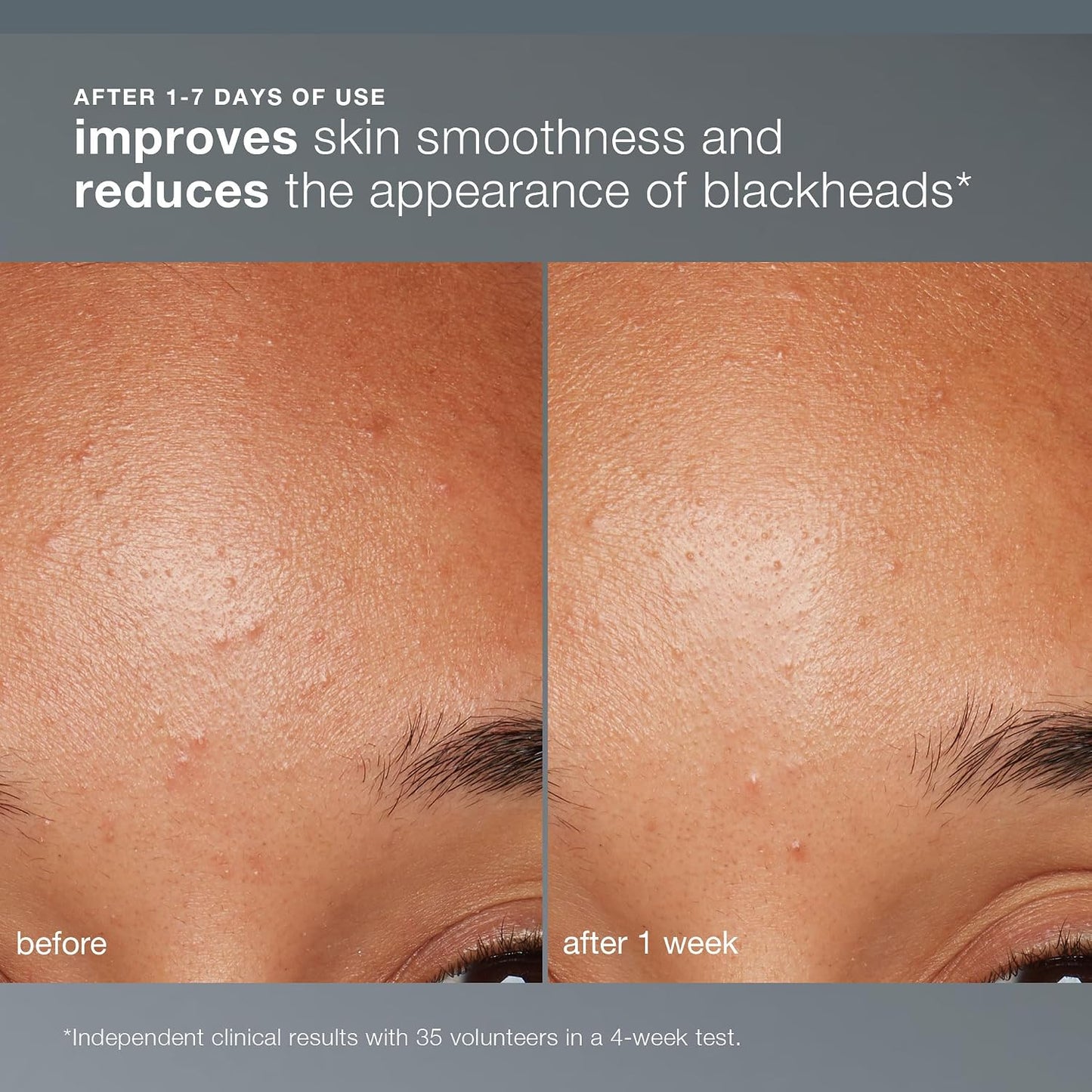 Dermalogica Daily Microfoliant, Face Exfoliator Scrub Powder with Salicylic Acid and Papaya Enzyme..