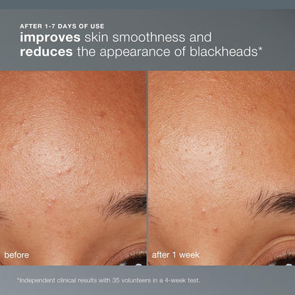 Dermalogica Daily Microfoliant, Face Exfoliator Scrub Powder with Salicylic Acid and Papaya Enzyme..