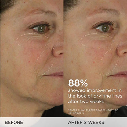 TATCHA The Dewy Skin Cream | Rich Line-Plumping Face Moisturizer | Helps Replenish Ceramides and Intensely Hydrate Dry &amp; Combo Skin ..