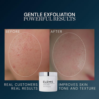 ELEMIS Dynamic Resurfacing Facial Pads, Gentle Textured Treatment