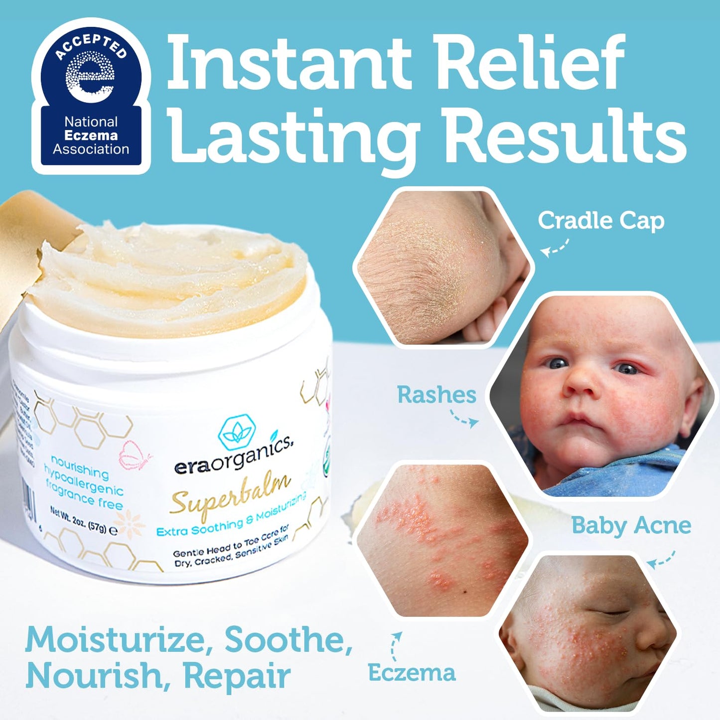 Era Organics Healing Ointment for Babies - USDA Certified Organic Natural Moisturizer Gentle on Sensitive Skin Prone To Baby Eczema..