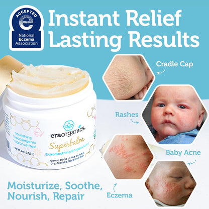 Era Organics Healing Ointment for Babies - USDA Certified Organic Natural Moisturizer Gentle on Sensitive Skin Prone To Baby Eczema..