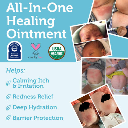 Era Organics Healing Ointment for Babies - USDA Certified Organic Natural Moisturizer Gentle on Sensitive Skin Prone To Baby Eczema..