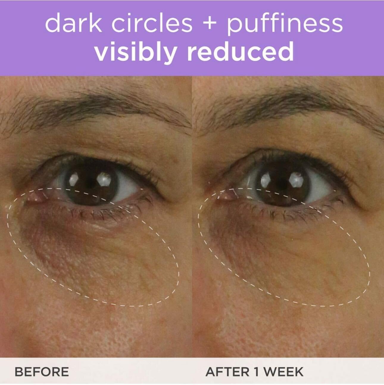 TATCHA The Brightening Eye Cream | Brightening &amp; Dark Circle Reduction with Vitamin C for Bight, Firm Undereyes