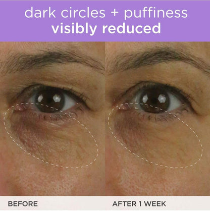 TATCHA The Brightening Eye Cream | Brightening &amp; Dark Circle Reduction with Vitamin C for Bight, Firm Undereyes
