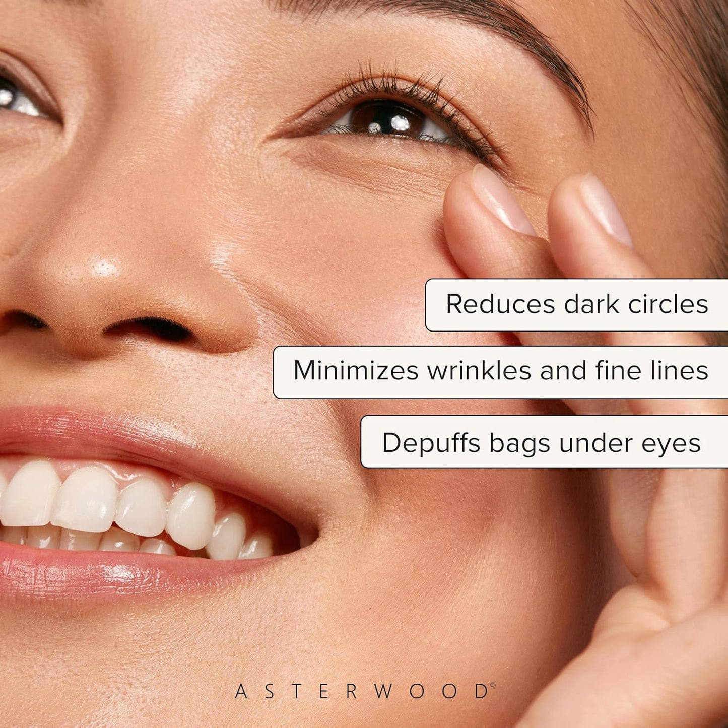 Triple Peptide Eye Serum - Matrixyl 3000 + Argireline + Caffeine + Hyaluronic Acid - Reduces Dark Circles, Puffy Eyes, Fine Lines, & Crow's Feet..