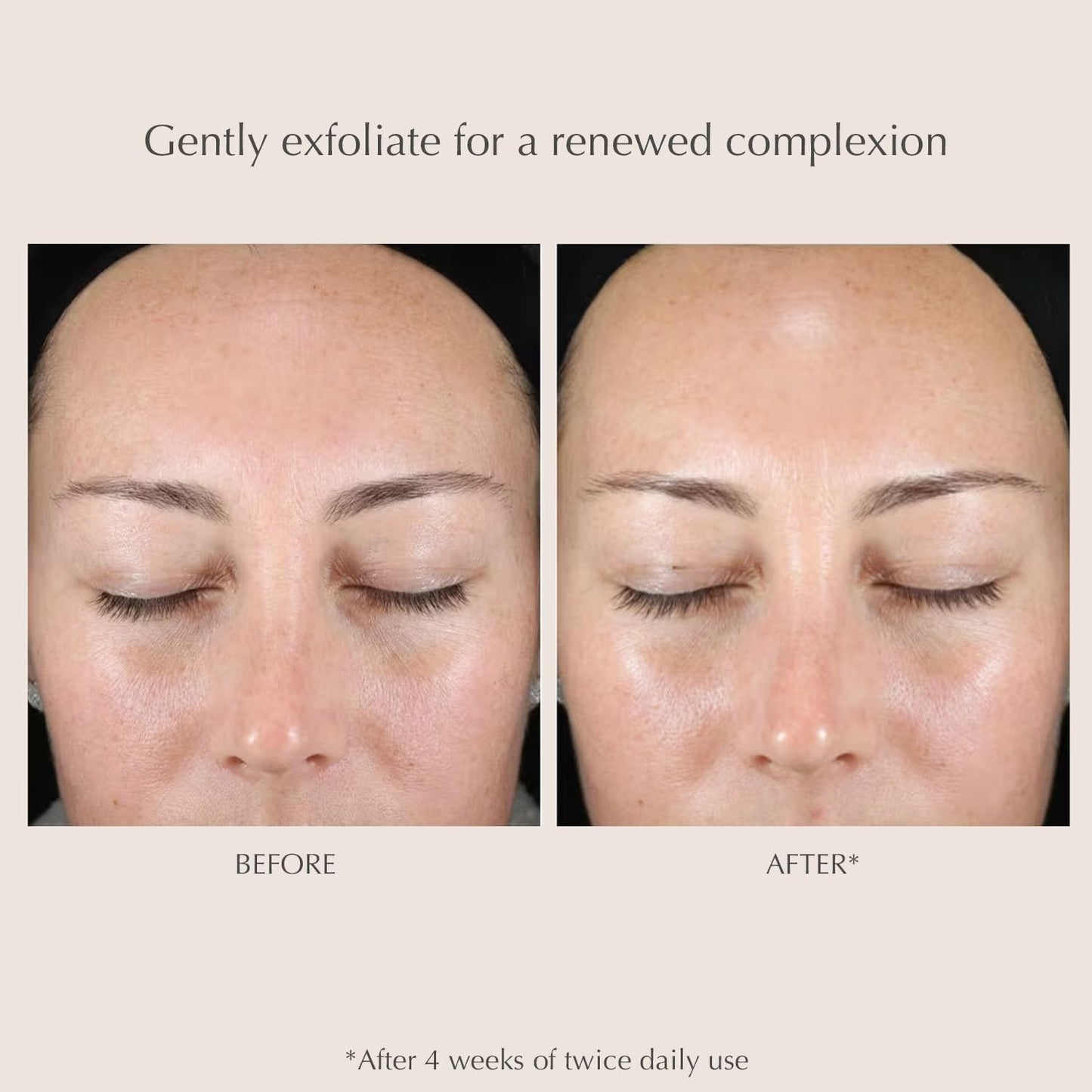 EXUVIANCE Gentle Daily Exfoliating Face Pads | PHA Toner &amp; Resurfacing Pore Pads with Vitamin C & E