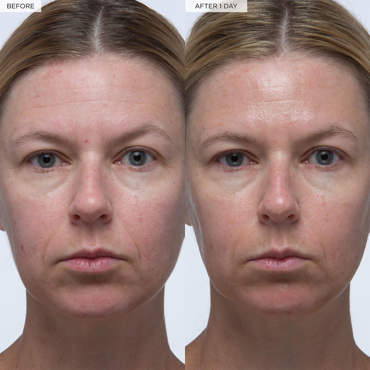 Glow Recipe Plum Plump Hyaluronic Acid Serum, Hydrating + Plumping Face Serum