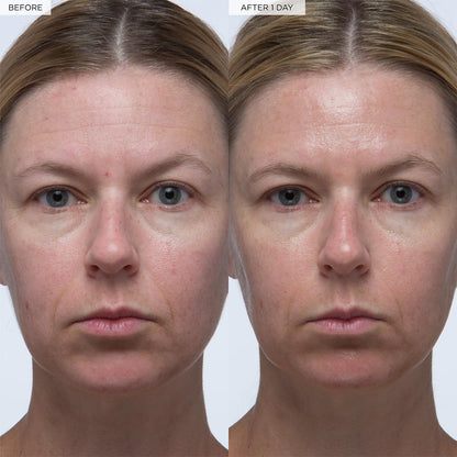 Glow Recipe Plum Plump Hyaluronic Acid Serum, Hydrating + Plumping Face Serum