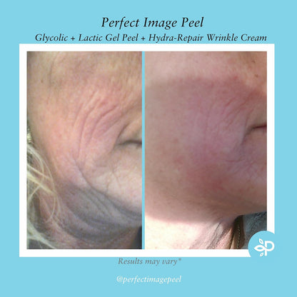 Glycolic Gel Peel - Enhanced with Retinol and Green Tea Extract (10% Strength)