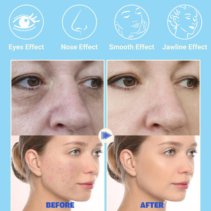 High Frequency Facial Device - TUMAKOU Blue High Frequency Facial Wand..