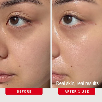 First Aid Beauty - Hydrating Serum with Hyaluronic Acid, Lightweight Formula
