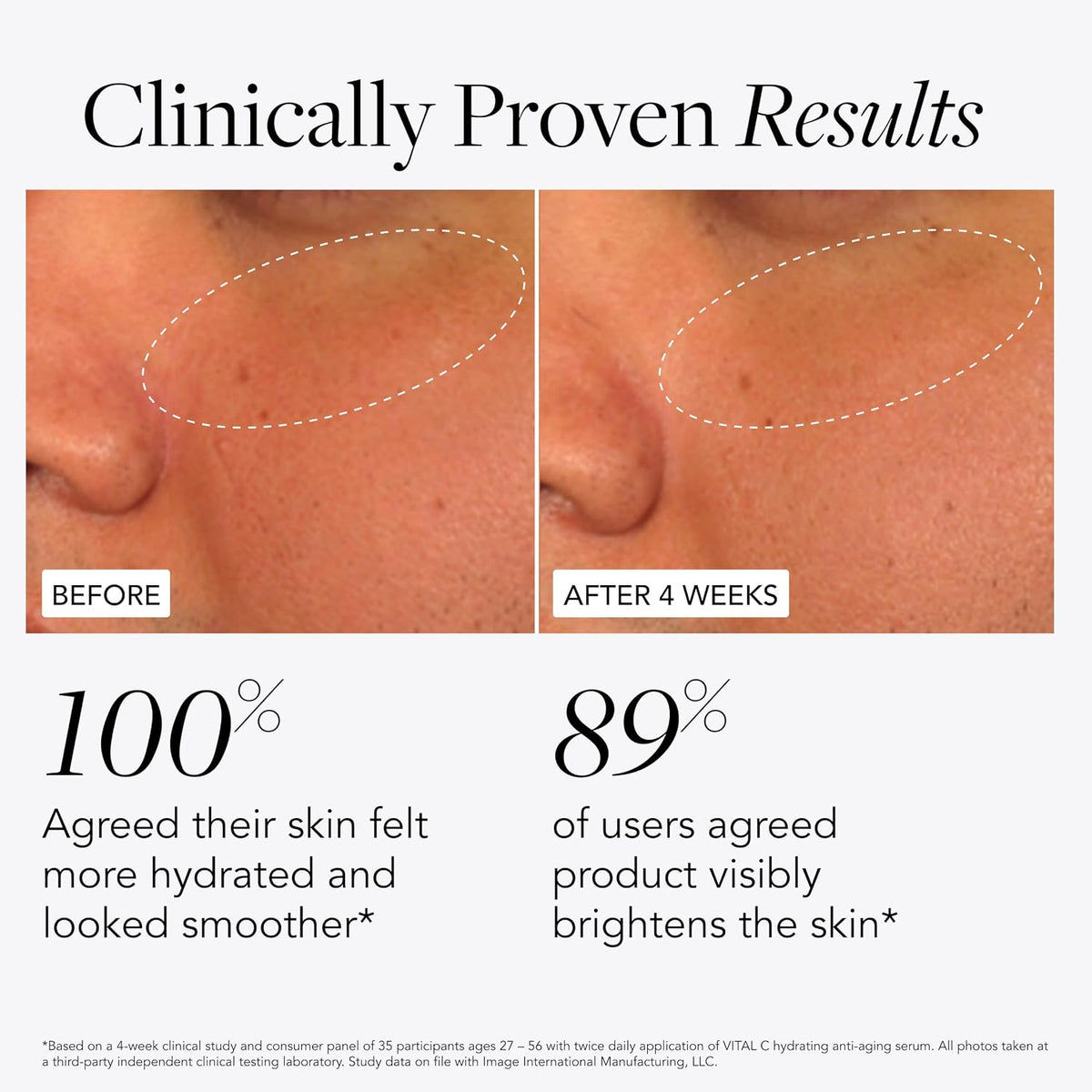 IMAGE Skincare, VITAL C Hydrating Face Serum, with Vitamin C and Hyaluronic Acid