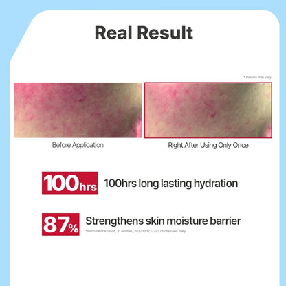 Illiyoon Ceramide Ato Concentrate Cream | Moisturizer for Dry &amp; Sensitive Skin, 100hr Lasting Hydration, For Face & Body..