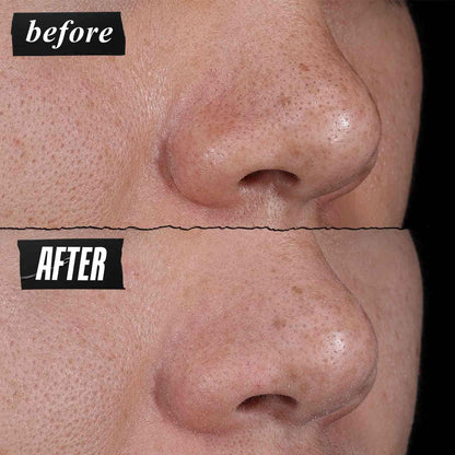 Kiehl's - Rare Earth Deep Pore Cleansing Mask, Visbily Minimizes Pores