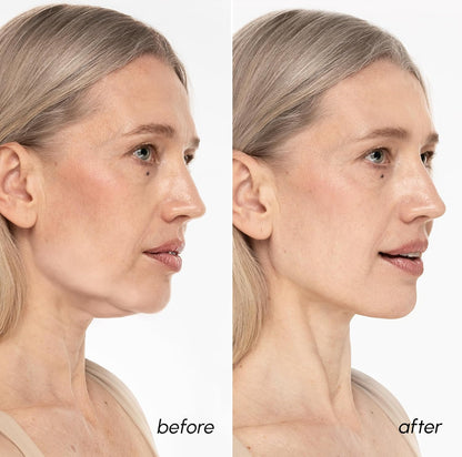 MAREE V Line Lifting Mask with 24K Gold – Deep Collagen Face Mask for Women – Jawline Shaper Mask with Retinol & Hyaluronic Acid..
