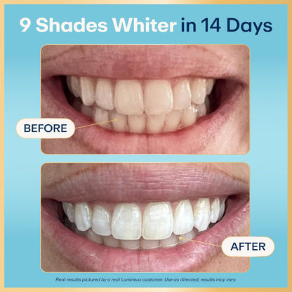 Lumineux Teeth Whitening Strips Kit - 9 Treatments (1 Month) | 9 Count